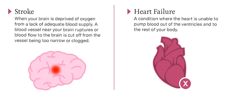 An infographic titled, "Types of Comorbidities". It lists Stroke and Heart Failure.